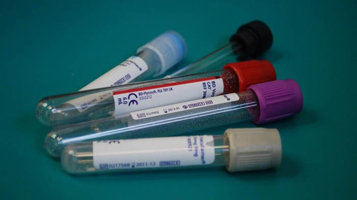 Двама български спортисти с положителни допинг тестове